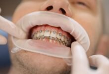 The Road to a Perfect Smile: Anticipations from an Orthodontist