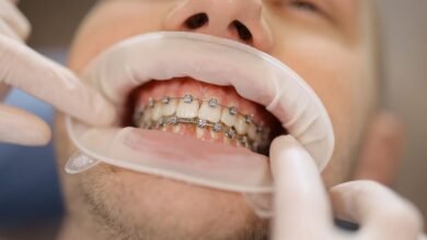 The Road to a Perfect Smile: Anticipations from an Orthodontist