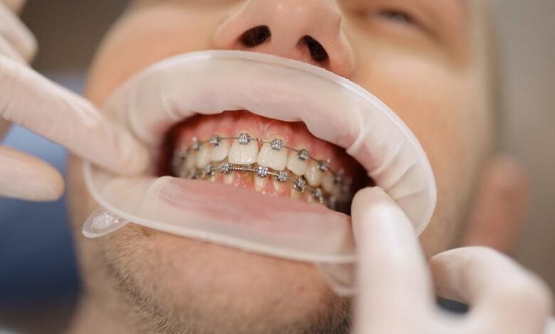 The Road to a Perfect Smile: Anticipations from an Orthodontist